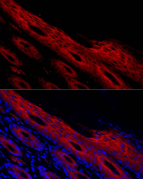 Immunocytochemistry/ Immunofluorescence: Periplakin Antibody - BSA Free [NBP2-94787] - Immunofluorescence analysis of human skin cells using Periplakin Rabbit pAb (A14051) at dilution of 1:500 (40x lens). Blue: DAPI for nuclear staining.