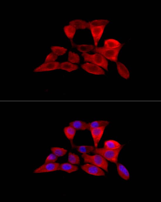Immunocytochemistry/ Immunofluorescence: OCTN2/SLC22A5 Antibody - BSA Free [NBP2-94796] - Immunofluorescence analysis of NIH/3T3 cells using OCTN2/SLC22A5 Rabbit pAb (A1676) at dilution of 1:200 (40x lens). Secondary antibody: Cy3 Goat Anti-Rabbit IgG (H+L) (AS007) at 1:500 dilution. Blue: DAPI for nuclear staining.