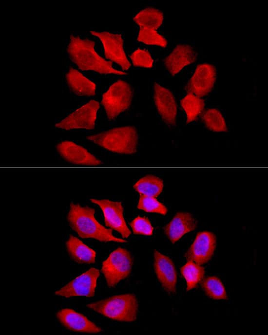 Immunocytochemistry/ Immunofluorescence OCTN2/SLC22A5 Antibody - BSA Free