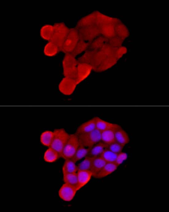 Immunocytochemistry/ Immunofluorescence OCTN2/SLC22A5 Antibody - BSA Free