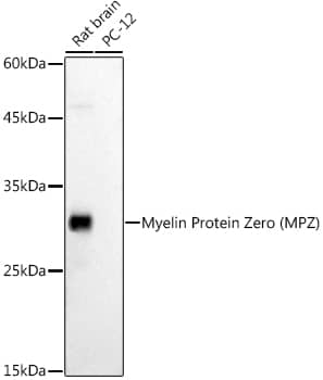 Western Blot: Myelin Protein Zero Antibody - BSA Free [NBP2-94812] - Western blot analysis of extracts of various cell lines, using Myelin Protein Zero antibody (A1687) at 1:1000 dilution.Secondary antibody: HRP Goat Anti-Rabbit IgG (H+L) (AS014) at 1:10000 dilution.Lysates/proteins: 25μg per lane.Blocking buffer: 3% nonfat dry milk in TBST.Detection: ECL Basic Kit (RM00020).Exposure time: 60s.