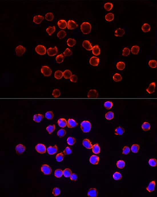 Immunocytochemistry/ Immunofluorescence: TSG101 Antibody - Azide and BSA Free [TSG101] - Immunofluorescence analysis of Jurkat cells using TSG101 Rabbit pAb  at dilution of 1:50 (40x lens). Secondary antibody: Cy3-conjugated Goat anti-Rabbit IgG (H+L)  at 1:500 dilution. Blue: DAPI for nuclear staining.