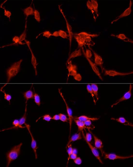 Immunocytochemistry/ Immunofluorescence: TSG101 Antibody - Azide and BSA Free [TSG101] - Immunofluorescence analysis of PC-12 cells using TSG101 Rabbit pAb  at dilution of 1:50 (40x lens). Secondary antibody: Cy3-conjugated Goat anti-Rabbit IgG (H+L)  at 1:500 dilution. Blue: DAPI for nuclear staining.