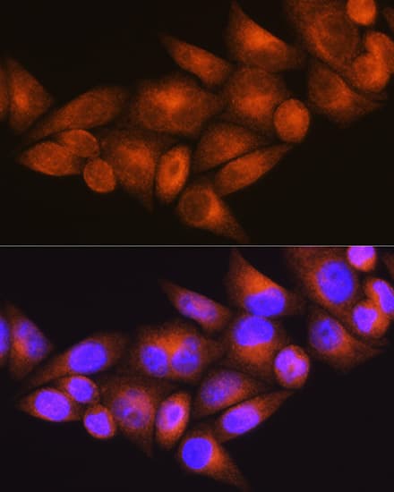 Immunocytochemistry/ Immunofluorescence: WFS1 Antibody - BSA Free [NBP2-94845] - Immunofluorescence analysis of HeLa cells using WFS1 Rabbit pAb (A1705) at dilution of 1:100 (40x lens). Blue: DAPI for nuclear staining.