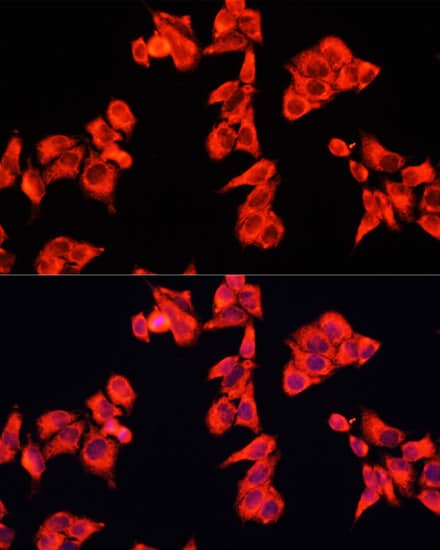 Immunocytochemistry/ Immunofluorescence RhoGAP Antibody - BSA Free