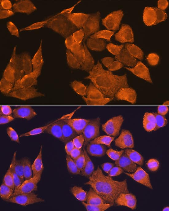 Immunocytochemistry/ Immunofluorescence PFDN5 Antibody - Azide and BSA Free