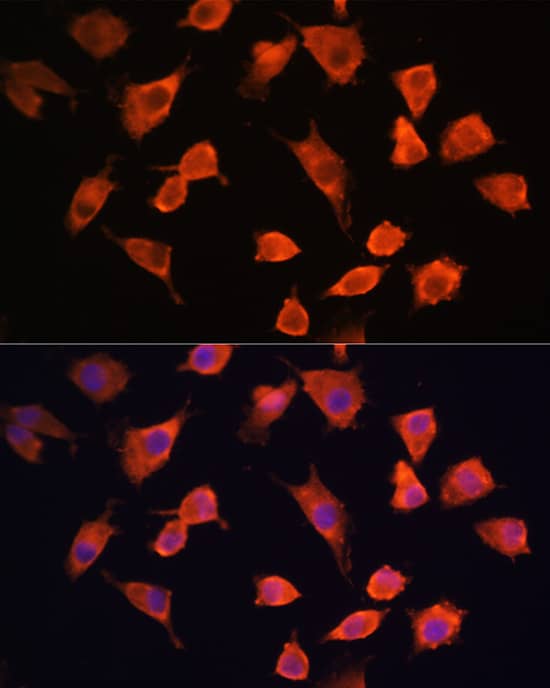 Immunocytochemistry/ Immunofluorescence: PFDN5 Antibody - Azide and BSA Free [NBP2-94869] - Immunofluorescence analysis of L929 cells using PFDN5 Rabbit pAb (A4014) at dilution of 1:100 (40x lens). Secondary antibody: Cy3 Goat Anti-Rabbit IgG (H+L) (AS007) at 1:500 dilution. Blue: DAPI for nuclear staining.