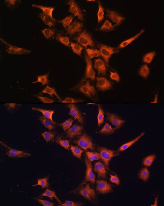 Immunocytochemistry/ Immunofluorescence PFDN5 Antibody - Azide and BSA Free