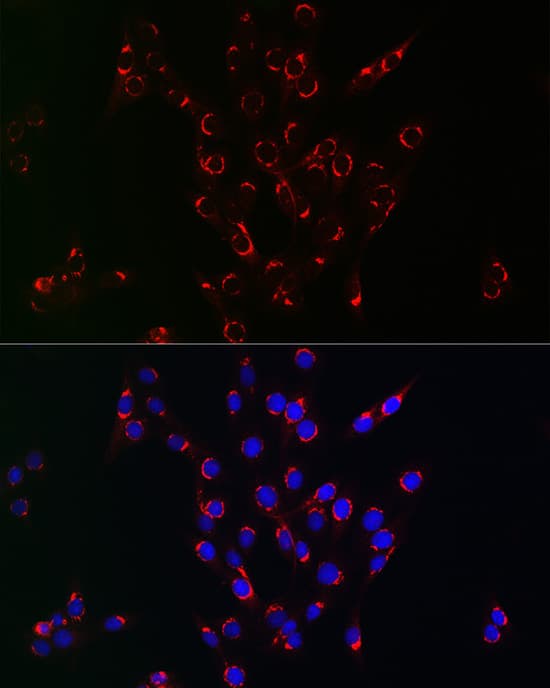 Immunocytochemistry/ Immunofluorescence: VPS34 Antibody - BSA Free [NBP2-94870] - Immunofluorescence analysis of PC-12 cells using VPS34 antibody (A4021) at dilution of 1:100. Blue: DAPI for nuclear staining.