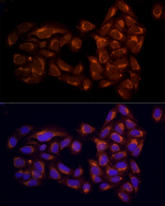 Immunocytochemistry/ Immunofluorescence RPH3AL Antibody - BSA Free