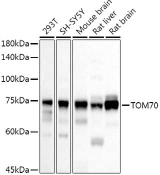 Western Blot: TOM70 Antibody - Azide and BSA Free [TOM70] - Western blot analysis of various lysates using TOM70 Rabbit pAb  at 1:500 dilution.Secondary antibody: HRP-conjugated Goat anti-Rabbit IgG (H+L)  at 1:10000 dilution.Lysates/proteins: 25ug per lane.Blocking buffer: 3% nonfat dry milk in TBST.Detection: ECL Basic Kit .Exposure time: 10s.