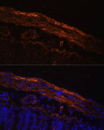 Immunocytochemistry/ Immunofluorescence: MYL9 Antibody - Azide and BSA Free [MYL9] - Immunofluorescence analysis of Rat intestine using MYL9 Rabbit pAb  at dilution of 1:100. Blue: DAPI for nuclear staining.