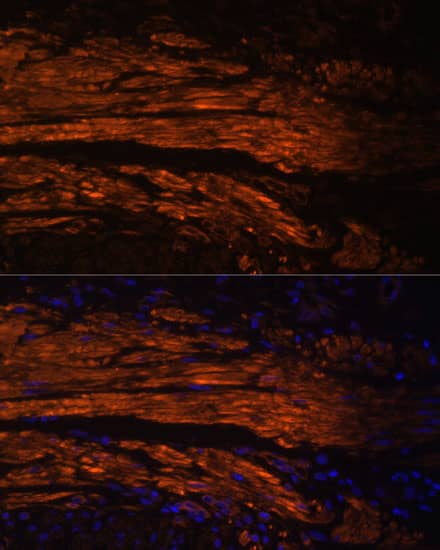 Immunocytochemistry/ Immunofluorescence: MYL9 Antibody - Azide and BSA Free [MYL9] - Immunofluorescence analysis of Human colon carcinoma using MYL9 Rabbit pAb  at dilution of 1:100. Blue: DAPI for nuclear staining.