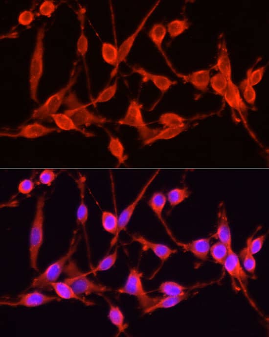 Immunocytochemistry/ Immunofluorescence: TSG101 Antibody - Azide and BSA Free [NBP2-94900] - Immunofluorescence analysis of PC-12 cells using TSG101 Rabbit pAb (A2216) at dilution of 1:100 (40x lens). Blue: DAPI for nuclear staining.