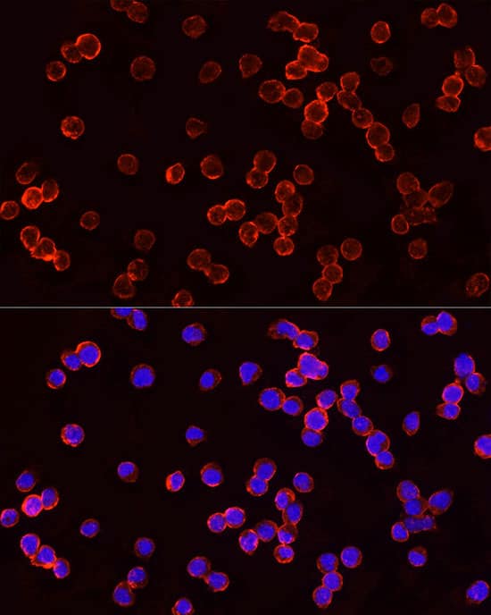 Immunocytochemistry/ Immunofluorescence: TSG101 Antibody - Azide and BSA Free [NBP2-94900] - Immunofluorescence analysis of Jurkat cells using TSG101 Rabbit pAb (A2216) at dilution of 1:100 (40x lens). Blue: DAPI for nuclear staining.