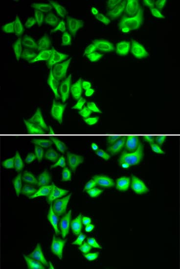 Immunocytochemistry/ Immunofluorescence: SG2NA Antibody - BSA Free [SG2NA] - Immunofluorescence analysis of HeLa cells using SG2NA Rabbit pAb . Secondary antibody: Cy3 Goat Anti-Rabbit IgG (H+L)  at 1:500 dilution. Blue: DAPI for nuclear staining.