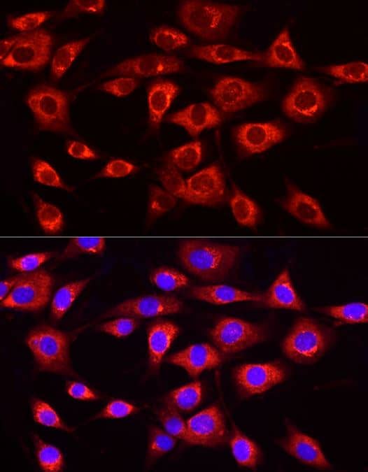 ICC/IF-MTTP Antibody - Azide and BSA Free-NBP2-94915-Analysis of NIH/3T3 cells using MTTP Rabbit pAb at dilution of 1:20 (40x lens). Blue: DAPI for nuclear staining.