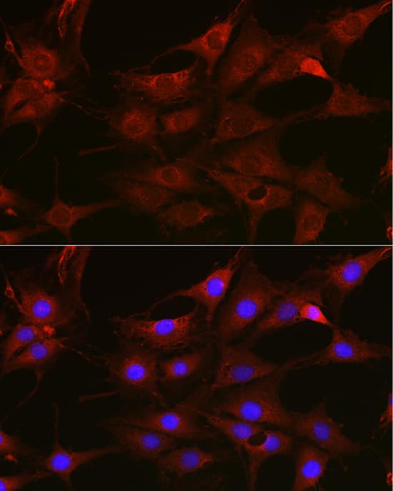 Immunocytochemistry/ Immunofluorescence: Rac1 Antibody - Azide and BSA Free [Rac1] - Immunofluorescence analysis of C6 cells using Rac1 Rabbit pAb  at dilution of 1:100 (40x lens). Secondary antibody: Cy3-conjugated Goat anti-Rabbit IgG (H+L)  at 1:500 dilution. Blue: DAPI for nuclear staining.