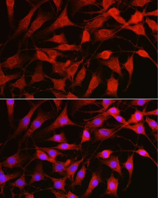 Immunocytochemistry/ Immunofluorescence: Rac1 Antibody - Azide and BSA Free [Rac1] - Immunofluorescence analysis of NIH/3T3 cells using Rac1 Rabbit pAb  at dilution of 1:100 (40x lens). Secondary antibody: Cy3-conjugated Goat anti-Rabbit IgG (H+L)  at 1:500 dilution. Blue: DAPI for nuclear staining.