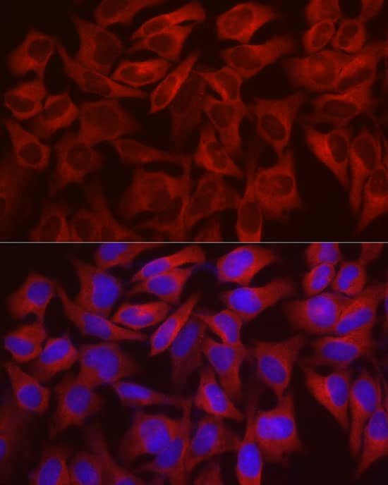Immunocytochemistry/ Immunofluorescence: WISP2 Antibody - Azide and BSA Free [NBP2-95088] - Immunofluorescence analysis of HeLa cells using WISP2 Rabbit pAb at dilution of 1:100 (40x lens). Secondary antibody: Cy3-conjugated Goat anti-Rabbit IgG (H+L) at 1:500 dilution. Blue: DAPI for nuclear staining.