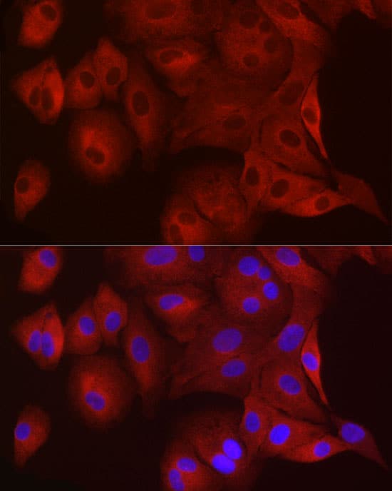 Immunocytochemistry/ Immunofluorescence WISP2 Antibody - Azide and BSA Free