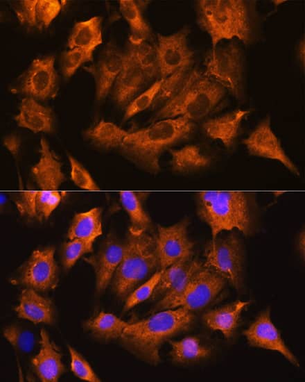 Immunocytochemistry/ Immunofluorescence: Sodium Potassium ATPase Beta 1 Antibody - BSA Free [Sodium Potassium ATPase Beta 1] - Immunofluorescence analysis of C6 cells using Sodium Potassium ATPase Beta 1 Rabbit pAb  at dilution of 1:100. Blue: DAPI for nuclear staining.
