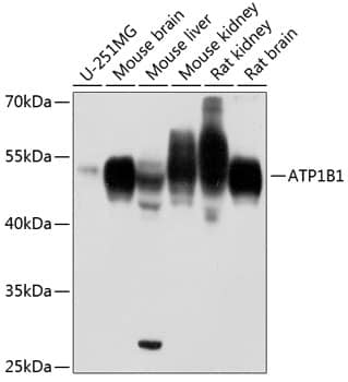 Western Blot: Sodium Potassium ATPase Beta 1 Antibody - BSA Free [Sodium Potassium ATPase Beta 1] - Western blot analysis of various lysates using Sodium Potassium ATPase Beta 1 Rabbit pAb  at 1:1000 dilution.Secondary antibody: HRP-conjugated Goat anti-Rabbit IgG (H+L)  at 1:10000 dilution.Lysates/proteins: 25ug per lane.Blocking buffer: 3% nonfat dry milk in TBST.Detection: ECL Basic Kit .Exposure time: 10s.