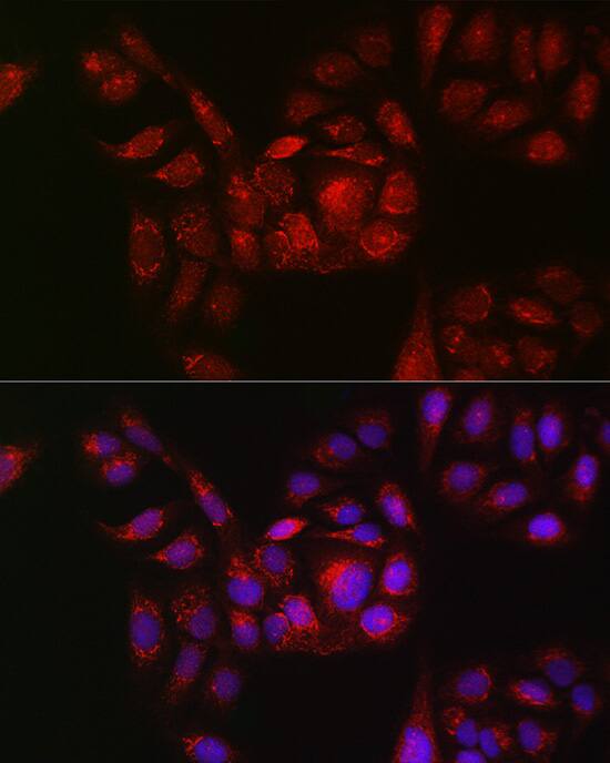 Immunocytochemistry/ Immunofluorescence: RAB11B Antibody - Azide and BSA Free [NBP2-95094] - Immunofluorescence analysis of U2OS cells using RAB11B Rabbit pAb (A15350) at dilution of 1:100 (40x lens). Blue: DAPI for nuclear staining.