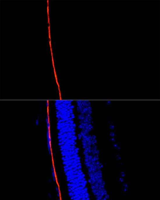 Immunocytochemistry/ Immunofluorescence: RPE65 Antibody - BSA Free [NBP2-95096] - Perform microwave antigen retrieval with 10 mM citrate buffer pH 6.0 before commencing with IF staining protocol.Immunofluorescence analysis of paraffin-embedded mouse retina using RPE65 Rabbit pAb (A9841) at dilution of 1:300 (40x lens). Secondary antibody: Cy3 Goat Anti-Rabbit IgG (H+L) (AS007) at 1:500 dilution. Blue: DAPI for nuclear staining.