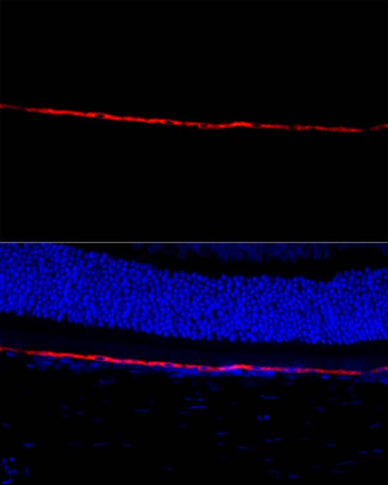 Immunocytochemistry/ Immunofluorescence: RPE65 Antibody - BSA Free [NBP2-95096] - Perform microwave antigen retrieval with 10 mM citrate buffer pH 6.0 before commencing with IF staining protocol.Immunofluorescence analysis of paraffin-embedded rat retina using RPE65 Rabbit pAb (A9841) at dilution of 1:300 (40x lens). Secondary antibody: Cy3 Goat Anti-Rabbit IgG (H+L) (AS007) at 1:500 dilution. Blue: DAPI for nuclear staining.