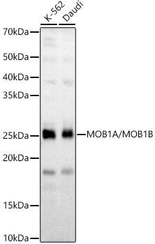 Western Blot: MOB4A/MOBKL1B Antibody - Azide and BSA Free [MOB4A/MOBKL1B] - Western blot analysis of various lysates, using MOB4A/MOBKL1B Rabbit pAb  at 1:1500 dilution.Secondary antibody: HRP-conjugated Goat anti-Rabbit IgG (H+L)  at 1:10000 dilution.Lysates/proteins: 25ug per lane.Blocking buffer: 3% nonfat dry milk in TBST.Detection: ECL Basic Kit .Exposure time: 10s.