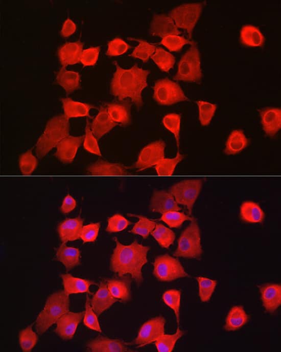 Immunocytochemistry/ Immunofluorescence: Notch-1 Antibody - Azide and BSA Free [Notch-1] - Immunofluorescence analysis of A-549 cells using Notch-1 Rabbit pAb  at dilution of 1:200 (40x lens). Secondary antibody: Cy3-conjugated Goat anti-Rabbit IgG (H+L)  at 1:500 dilution. Blue: DAPI for nuclear staining.