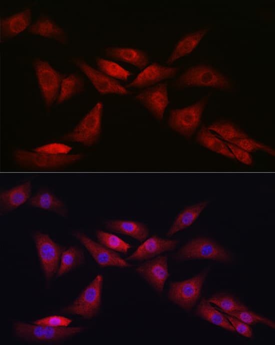 Immunocytochemistry/ Immunofluorescence: Notch-1 Antibody - Azide and BSA Free [Notch-1] - Immunofluorescence analysis of NIH/3T3 cells using Notch-1 Rabbit pAb  at dilution of 1:200 (40x lens). Secondary antibody: Cy3-conjugated Goat anti-Rabbit IgG (H+L)  at 1:500 dilution. Blue: DAPI for nuclear staining.