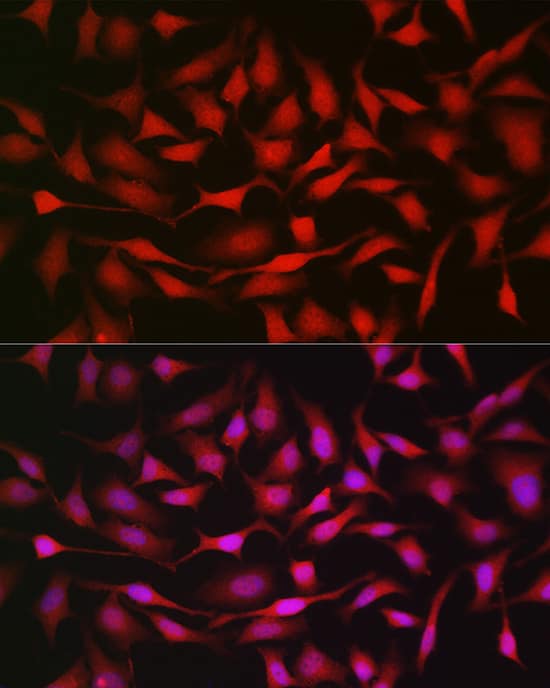 Immunocytochemistry/ Immunofluorescence: Notch-1 Antibody - Azide and BSA Free [Notch-1] - Immunofluorescence analysis of HeLa cells using Notch-1 Rabbit pAb  at dilution of 1:200 (40x lens). Secondary antibody: Cy3-conjugated Goat anti-Rabbit IgG (H+L)  at 1:500 dilution. Blue: DAPI for nuclear staining.