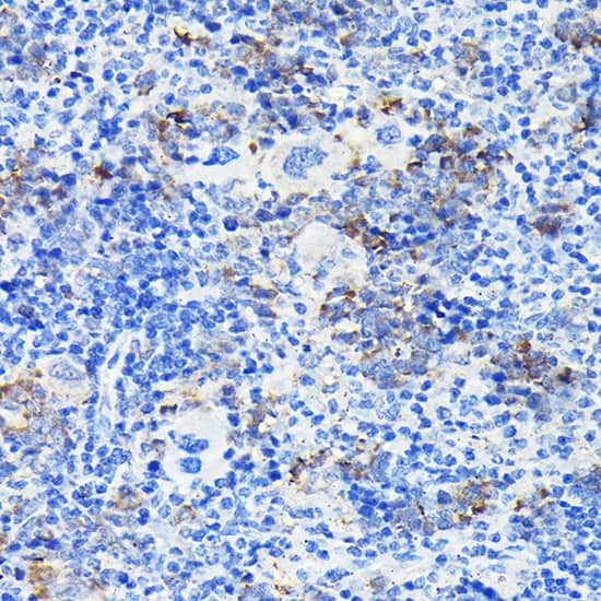 Immunohistochemistry: Notch-1 Antibody - Azide and BSA Free [Notch-1] - Immunohistochemistry analysis of paraffin-embedded Mouse spleen using Notch-1 Rabbit pAb  at dilution of 1:100 (40x lens). High pressure antigen retrieval performed with 0.01M Citrate Bufferr (pH 6.0) prior to IHC staining.