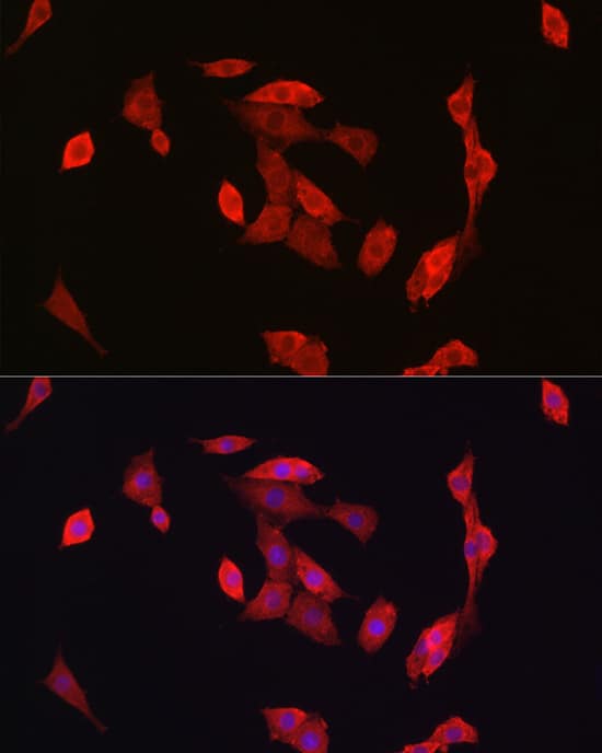 Immunocytochemistry/ Immunofluorescence: Notch-1 Antibody - Azide and BSA Free [Notch-1] - Immunofluorescence analysis of PC-12 cells using Notch-1 Rabbit pAb  at dilution of 1:200 (40x lens). Secondary antibody: Cy3-conjugated Goat anti-Rabbit IgG (H+L)  at 1:500 dilution. Blue: DAPI for nuclear staining.