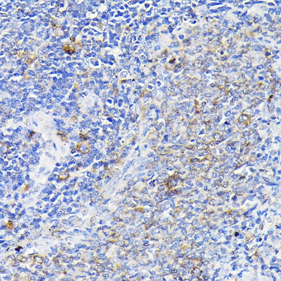 Immunohistochemistry: Notch-1 Antibody - Azide and BSA Free [Notch-1] - Immunohistochemistry analysis of paraffin-embedded Rat spleen using Notch-1 Rabbit pAb  at dilution of 1:100 (40x lens). High pressure antigen retrieval performed with 0.01M Citrate Bufferr (pH 6.0) prior to IHC staining.