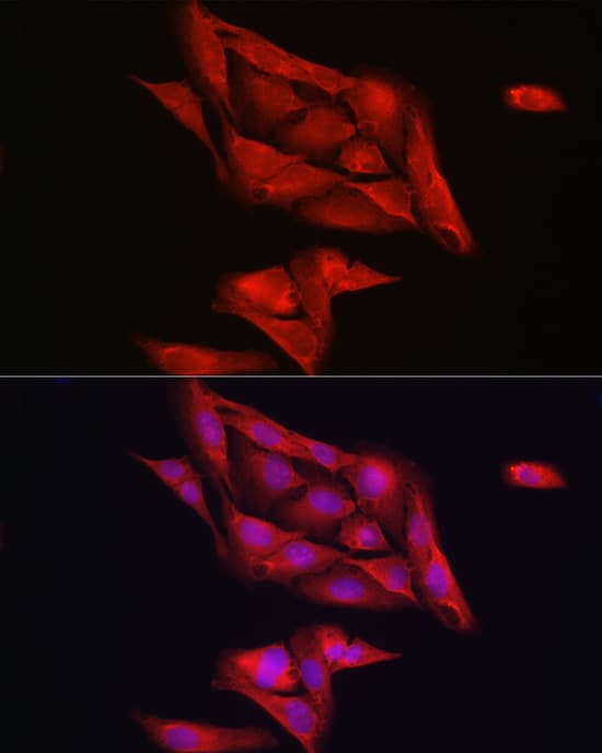 Immunocytochemistry/ Immunofluorescence: Notch-1 Antibody - Azide and BSA Free [Notch-1] - Immunofluorescence analysis of U2OS cells using Notch-1 Rabbit pAb  at dilution of 1:200 (40x lens). Secondary antibody: Cy3-conjugated Goat anti-Rabbit IgG (H+L)  at 1:500 dilution. Blue: DAPI for nuclear staining.