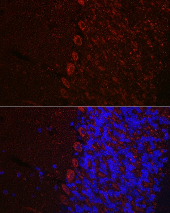 Immunocytochemistry/ Immunofluorescence Orexin R1/HCRTR1 Antibody - Azide and BSA Free