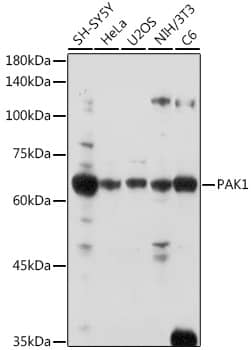 Western Blot: PAK1 Antibody - Azide and BSA Free [PAK1] - Western blot analysis of various lysates using PAK1 Rabbit pAb  at 1:1000 dilution.Secondary antibody: HRP-conjugated Goat anti-Rabbit IgG (H+L)  at 1:10000 dilution.Lysates/proteins: 25ug per lane.Blocking buffer: 3% nonfat dry milk in TBST.Detection: ECL Basic Kit .Exposure time: 180s.