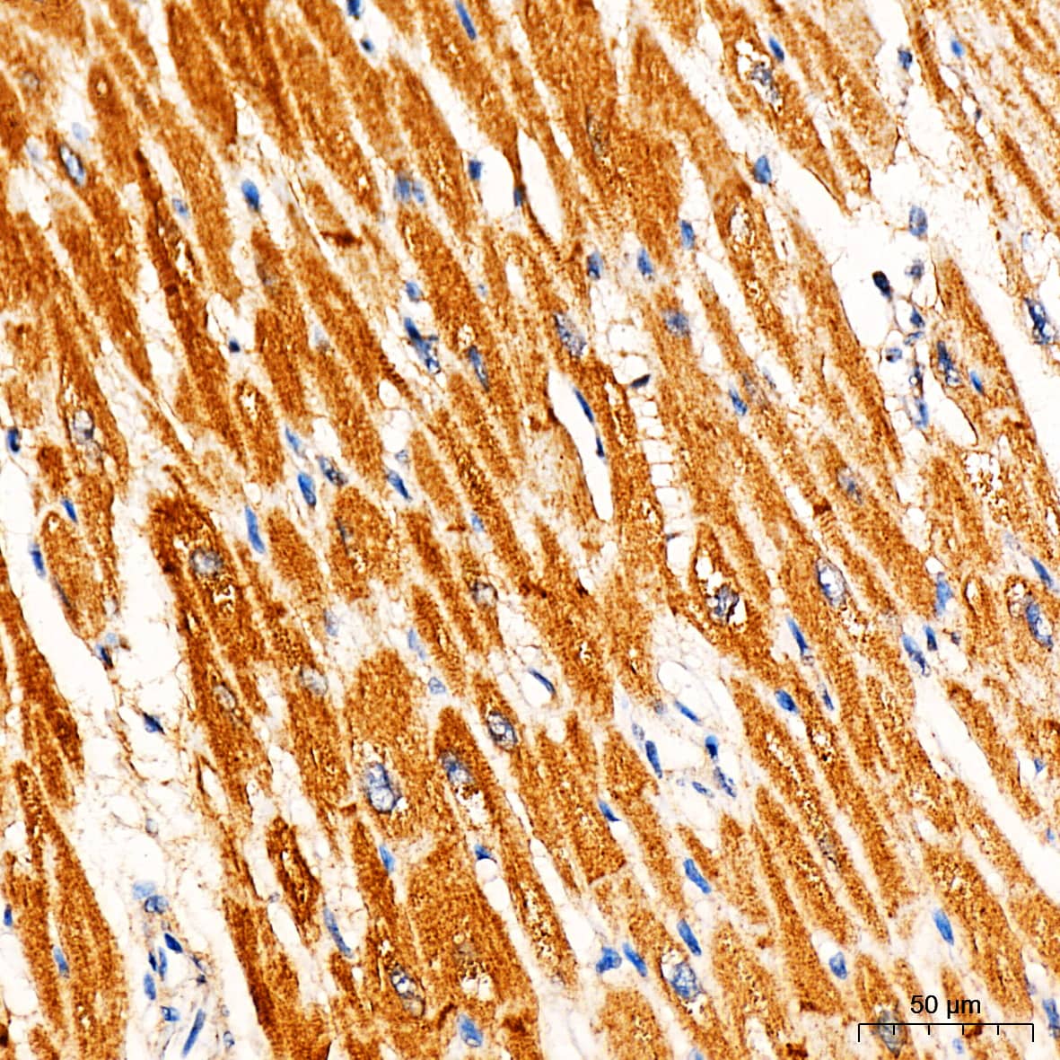 Immunohistochemistry: Ryanodine Receptor 2 Antibody - Azide and BSA Free [Ryanodine Receptor 2] - Immunohistochemistry analysis of paraffin-embedded Human heart tissue using Ryanodine Receptor 2 Rabbit pAb  at a dilution of 1:300 (40x lens). High pressure antigen retrieval performed with 0.01M Citrate Bufferr (pH 6.0) prior to IHC staining.