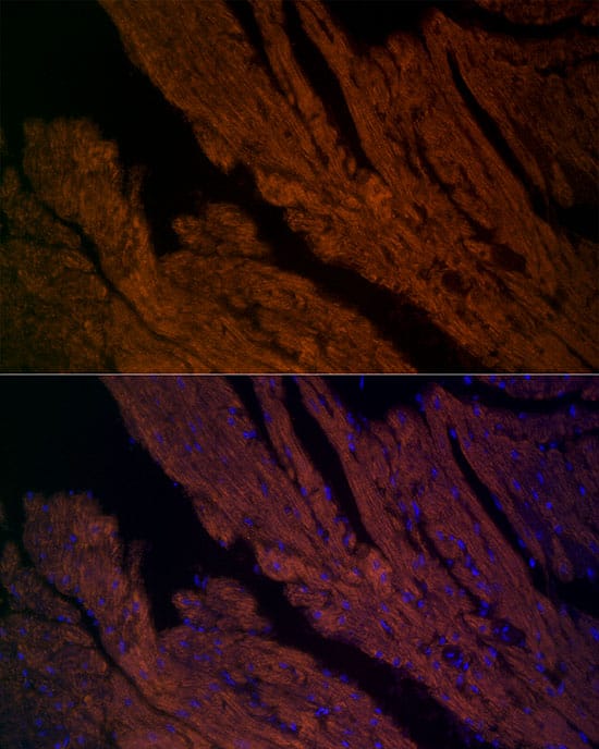 Immunocytochemistry/ Immunofluorescence: Ryanodine Receptor 2 Antibody - Azide and BSA Free [Ryanodine Receptor 2] - Immunofluorescence analysis of paraffin-embedded mouse heart using Ryanodine Receptor 2 Rabbit pAb  at dilution of 1:200 (40x lens). Secondary antibody: Cy3-conjugated Goat anti-Rabbit IgG (H+L)  at 1:500 dilution. Blue: DAPI for nuclear staining.