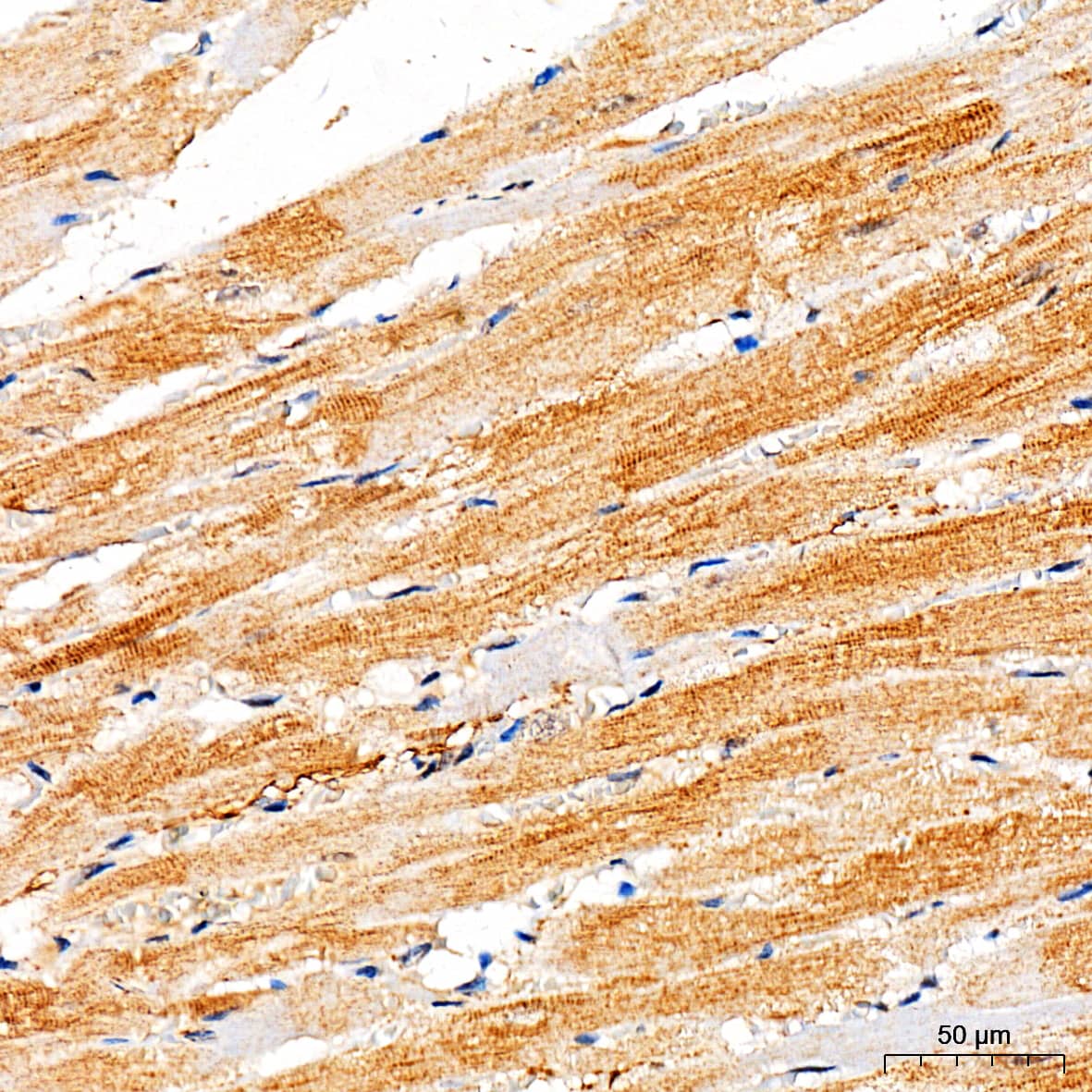 Immunohistochemistry: Ryanodine Receptor 2 Antibody - Azide and BSA Free [Ryanodine Receptor 2] - Immunohistochemistry analysis of paraffin-embedded Rat heart tissue using Ryanodine Receptor 2 Rabbit pAb  at a dilution of 1:300 (40x lens). High pressure antigen retrieval performed with 0.01M Citrate Bufferr (pH 6.0) prior to IHC staining.