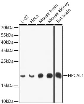 Western Blot: VILIP3 Antibody - BSA Free [NBP2-95122] - Western blot analysis of various lysates using VILIP3 Rabbit pAb (A10019) at 1:1000 dilution. Secondary antibody:HRP Goat Anti-Rabbit IgG (H+L)(AS014) at 1:10000 dilution. Lysates / proteins: 25 μg per lane. Blocking buffer: 3 % nonfat dry milk in TBST. Detection:ECL Basic Kit (RM00020). Exposuretime: 90s.