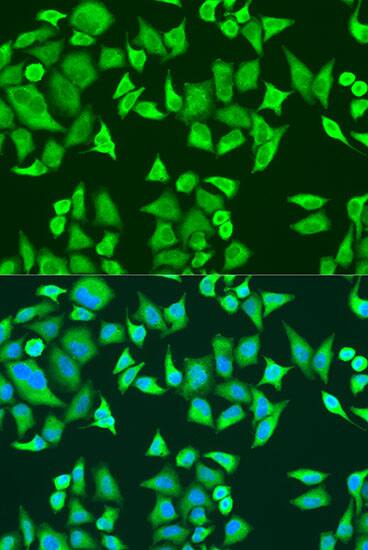 Immunocytochemistry/ Immunofluorescence: SMN2 Antibody - BSA Free [NBP2-95125] - Immunofluorescence analysis of U2OS cells using SMN2 antibody (A12519) at dilution of 1:100. Blue: DAPI for nuclear staining.