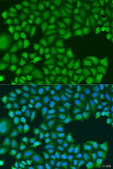 Immunocytochemistry/ Immunofluorescence: TIRAP Antibody - BSA Free [NBP2-95138] - Immunofluorescence analysis of U2OS cells using TIRAP antibody (A12606) at dilution of 1:100. Blue: DAPI for nuclear staining.