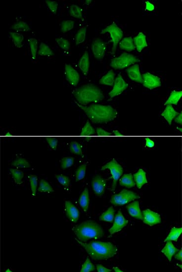 Immunocytochemistry/ Immunofluorescence: PSG1 Antibody - BSA Free [PSG1] - Immunofluorescence analysis of U2OS cells using PSG1 Rabbit pAb . Secondary antibody: Cy3 Goat Anti-Rabbit IgG (H+L)  at 1:500 dilution. Blue: DAPI for nuclear staining.