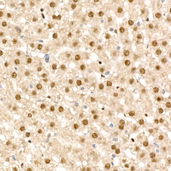 Immunohistochemistry RAD54L2 Antibody - BSA Free
