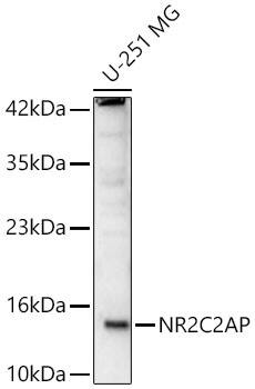 Western Blot: TRA16 Antibody - Azide and BSA Free [NBP2-95151] - Western blot analysis of lysates from U-251 MG cells using TRA16 Rabbit pAb(A14960) at 1:1000 dilution.Secondary antibody: HRP Goat Anti-Rabbit IgG (H+L) (AS014) at 1:10000 dilution.Lysates/proteins: 25 μg per lane.Blocking buffer: 3% nonfat dry milk in TBST.Detection: ECL Basic Kit (RM00020).Exposure time: 90s.