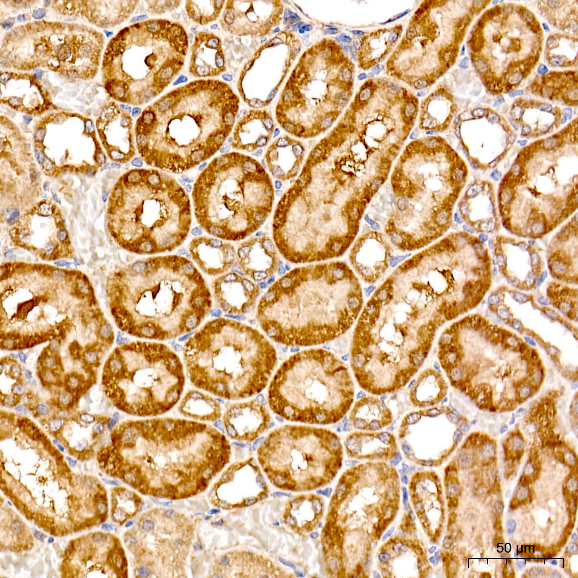 Immunohistochemistry: TAT Antibody - BSA Free [NBP2-95202] - Immunohistochemistry analysis of TAT in paraffin-embedded rat kidney tissue using TAT Rabbit pAb (A6764) at a dilution of 1:500 (40x lens). High pressure antigen retrieval was performed with 0.01 M citrate buffer (pH 6.0) prior to IHC staining.